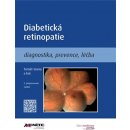 Diabetická retinopatie - Tomáš Sosna, kol.