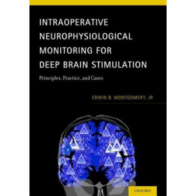 Intraoperative Neurophysiological Monitoring for Deep Brain Stimulation