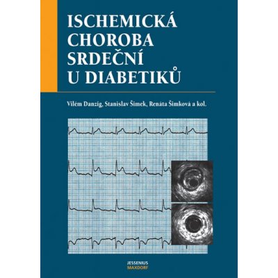 Ischemická choroba srdeční - Vilém Danzig, Stanislav Šimek – Zbozi.Blesk.cz