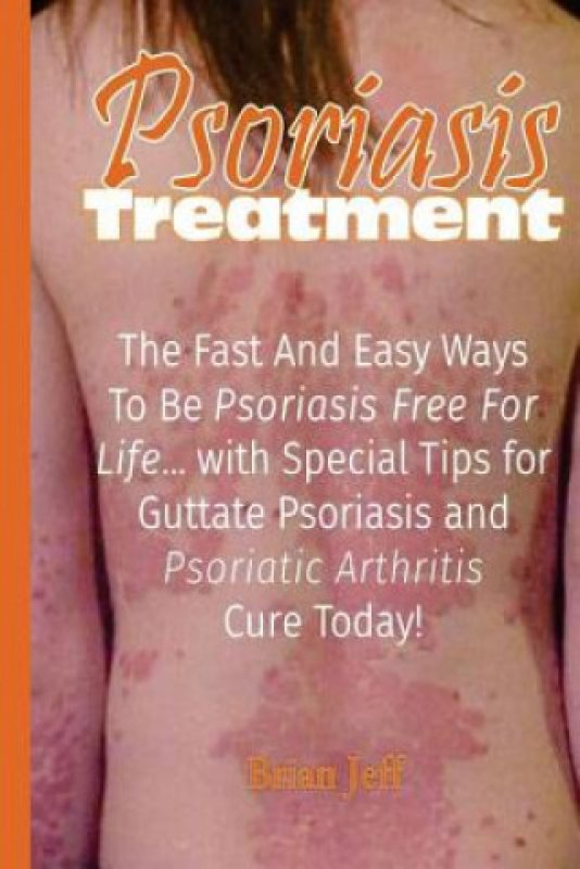 Psoriasis Treatment The Fast and Easy Ways to Be Psoriasis Free for