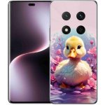 mmCase na Honor Magic 7 Lite 5G - kachnička – Zboží Živě