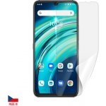 Ochranná fólie Screenshield UMIDIGI A9 Plus - displej – Zbozi.Blesk.cz