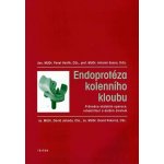 Endoprotéza kolenního kloubu -- Průvodce obdobím operace, rehabilitací a dalším životem. Pavel Vavřík, Antonín Sosna – Hledejceny.cz