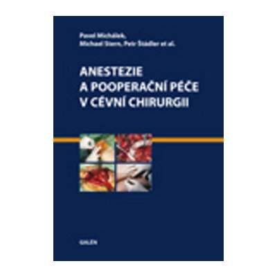 Anestezie a pooperační péče v cévní chirurgii - Petr Štádler, Pavel Michálek, Michael Stern – Hledejceny.cz