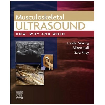 Musculoskeletal Ultrasound