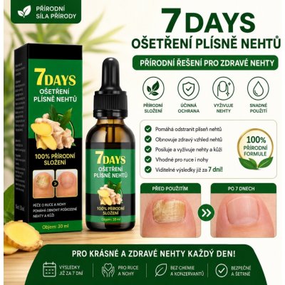 7Days Kapky na Plíseň Nehtů na Nohou 30 ml – Zboží Dáma