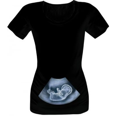 Tričko s potiskem Tehotenské tričko ultrazvuk dámské Černá
