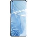 Ochranná fólie Screenshield Xiaomi Mi 11 – Sleviste.cz