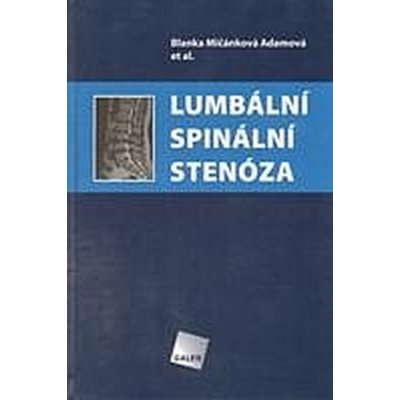 Lumbální spinální stenóza - Blanka Mičánková Adamová