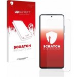 Ochranná fólie Hydrogel Xiaomi Redmi Note 11 / Note 11S – Sleviste.cz