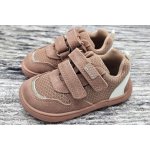 Protetika Alex nude – Zbozi.Blesk.cz