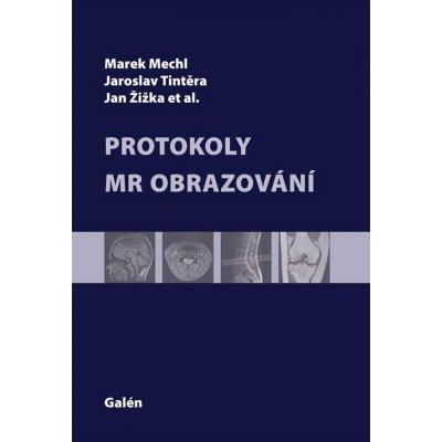 Protokoly v MR zobrazování - Jaroslav Tintěra, Marek Mechl, Jan Žižka – Hledejceny.cz