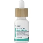 LOBEY Lokální sérum na akné s okamžitým účinkem 15 ml – Hledejceny.cz