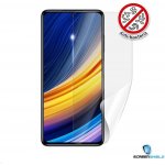 Ochranná fólie Screenshield XIAOMI POCO F3 – Zboží Živě