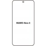 Ochranná fólie Hydrogel Huawei Nova 9 – Hledejceny.cz