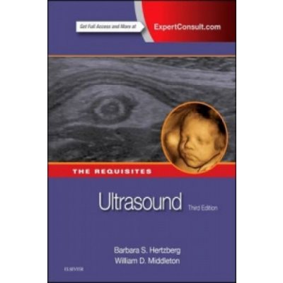 Hertzberg, Barbara S: Ultrasound – Zboží Mobilmania