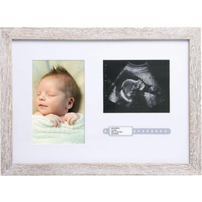 Pearhead Fotorámeček na foto z ultrazvuku | přírodní