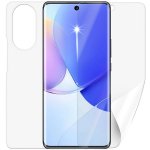 Ochranná fólie Screenshield HUAWEI Nova 9 - celé tělo – Hledejceny.cz