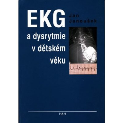 EKG a dysrytmie v dětském věku – Hledejceny.cz