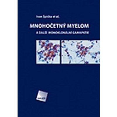 Mnohočetný myelom a další monoklonální gamapatie