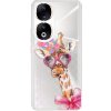 Pouzdro a kryt na mobilní telefon Honor iSaprio Lady Giraffe Honor 90 5G