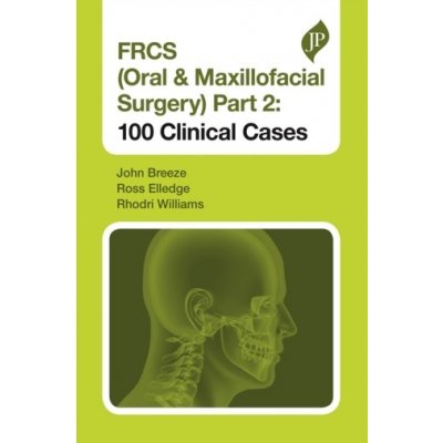 FRCS Oral a Maxillofacial Surgery Part 2: 100 Clinical Cases – Zboží Mobilmania