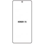 Ochranná fólie Hydrogel Huawei Honor 70 – Zboží Živě