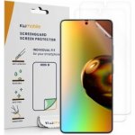 Ochranná fólie kwmobile Xiaomi Redmi Note 13 5G, 3ks – Zbozi.Blesk.cz