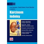 Karcinom ledviny + DVD - doc. MUDr. Karel Odrážka, Ph.D. – Hledejceny.cz