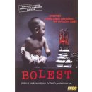 Bolest DVD