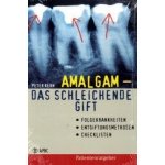 Amalgam - das schleichende Gift – Hledejceny.cz