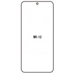 Ochranná fólie Hydrogel Xiaomi 12/ Xiaomi 12X – Zboží Mobilmania