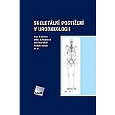 Skeletální postižení v uroonkologii – Zboží Mobilmania