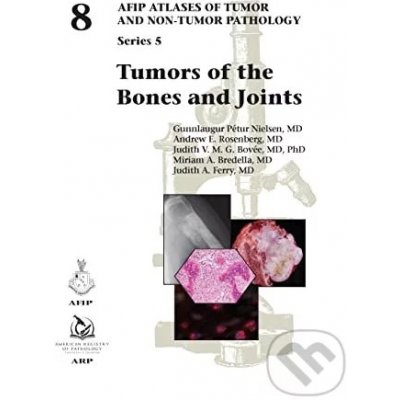 Tumors of the Bones and Joints – Zboží Mobilmania
