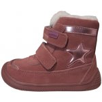 Protetika Linet růžová – Hledejceny.cz