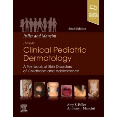 Paller and Mancini - Hurwitz Clinical Pediatric Dermatology – Zbozi.Blesk.cz