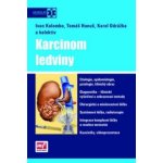 Karcinom ledviny + DVD - doc. MUDr. Karel Odrážka, Ph.D. – Hledejceny.cz