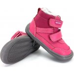 Protetika Tyrel Koral – Zboží Dáma