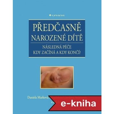 Předčasně narozené dítě: Následná péče - kdy začíná a kdy končí? - Daniela Marková, Weberová Magdalena Chvílová, kolektiv a – Zboží Mobilmania