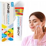 Unia Acne Derm krém proti akné 20 g – Hledejceny.cz