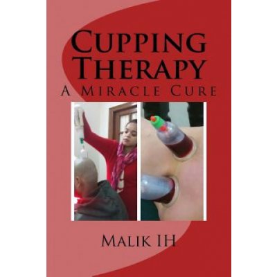 Cupping Therapy: A Miracle Cure – Sleviste.cz