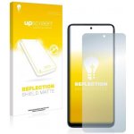 Ochranné fólie ScreenShield XIAOMI Redmi Note 12 - displej – Hledejceny.cz