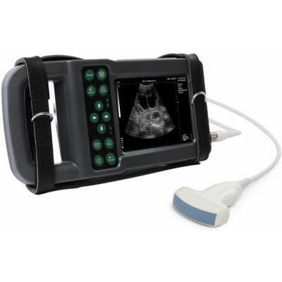 XUZHOU KAIXIN ELECTRON Ultrazvukový skener KX5600L s digitální abdominální sondou – Hledejceny.cz