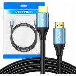 Vention ALHSK – Zboží Živě