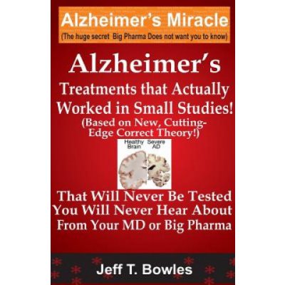 Alzheimer's Treatments That Actually Worked in Small Studies – Zbozi.Blesk.cz