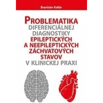 Problematika diferenciálnej diagnostiky epileptických a neepileptických záchvatových stavov v klinickej praxi - Branislav Kollár – Hledejceny.cz