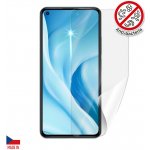 Ochranná fólie ScreenShield XIAOMI 11 Lite 5G NE - displej – Zbozi.Blesk.cz