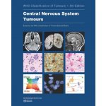 WHO Classification of Tumours: Central Nervous System Tumours - World Health Organization – Hledejceny.cz