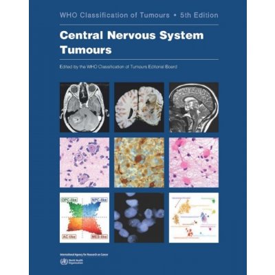 WHO Classification of Tumours: Central Nervous System Tumours - World Health Organization – Hledejceny.cz