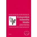 Kniha Endoprotéza kolenního kloubu -- Průvodce obdobím operace, rehabilitací a dalším životem. Pavel Vavřík, Antonín Sosna